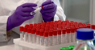 Coronavirus: la Argentina probará en humanos un suero hiperinmune de caballos